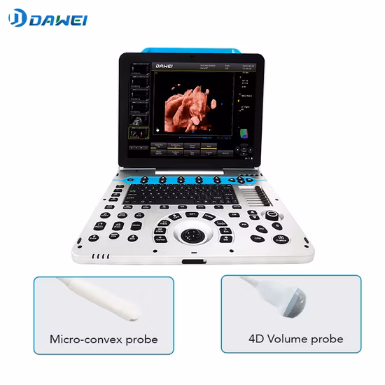 Chison Ebit50 4D 5D Portátil Color Doppler Digital Dianostic Imaging System Ginecologia de ultrassom humano, máquina de eco cardiovascular